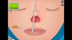 Operate Now: Nose Surgery - Walkthrough