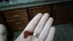 Порез. Как остановить кровь в домашних условиях. Лайфхак от Шарифа.