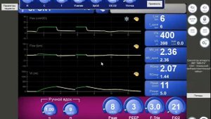 Симулятор АВЕНТА PSV ХОБЛ и ОРДС (Л.№5) Горячев А.С