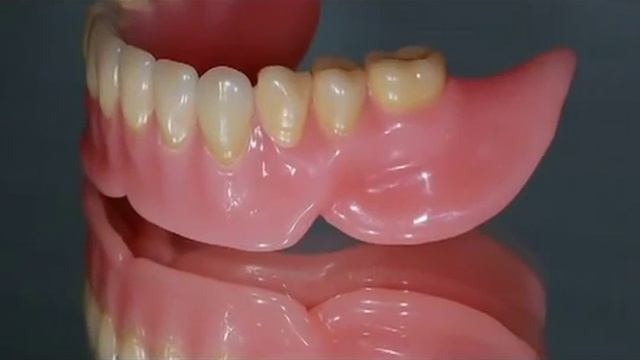 Плюсы и минусы съёмных нейлоновых зубных протезов смотреть онлайн