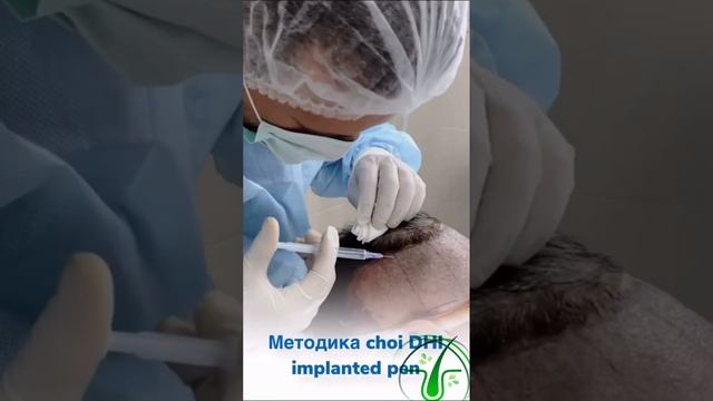 Максимально естественный результат ??#пересадкаволостурция #пересадкаволосмосква #shots