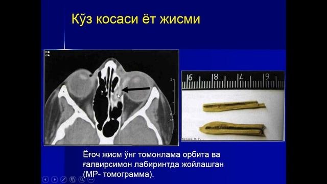 Жарохатлар
