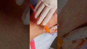 Нити DOUBLE SCREW. Красивый овал без брылей