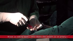 Coronary angiogram | a live demonstration