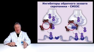 Новые подходы к лечению мигрени. Хороший пример.