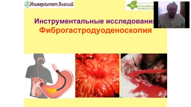 А. Данилко (28.02.2016) Язвенная болезнь желудка и 12 перст кишки смотреть онлайн