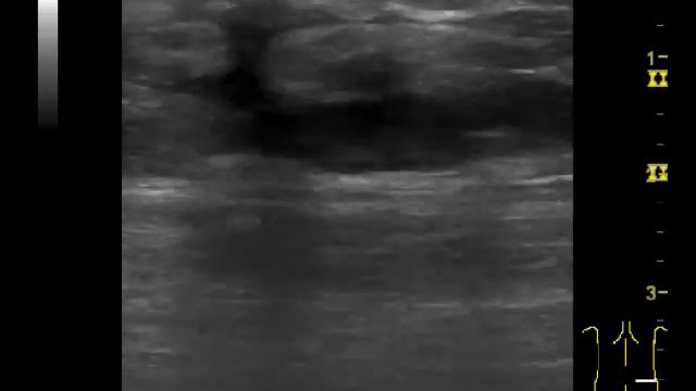 ягодица смотреть онлайн