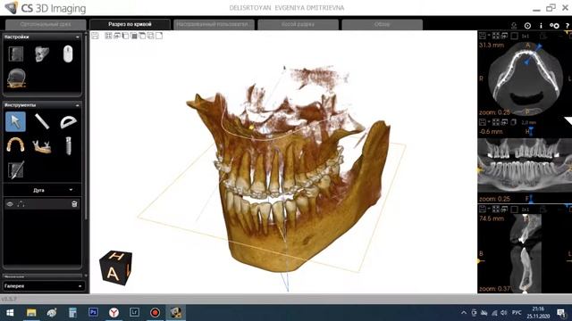 Самая простая программа для просмотра кт пациентов смотреть онлайн