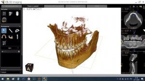 Самая простая программа для просмотра кт пациентов