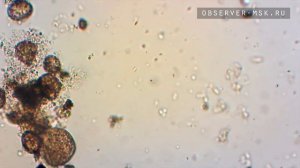 Бактерии в капле воды (росы) под микроскопом