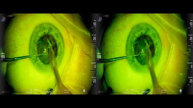 Lukan Mishev live stream смотреть онлайн