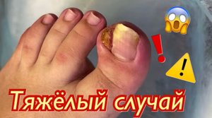 Тяжёлый случай??⚠️❗️??