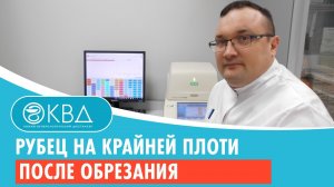 ? Рубец на крайней плоти после обрезания. Клинический случай №212