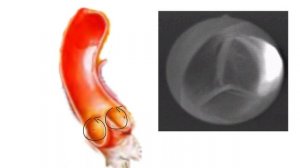 восходящая часть аорты