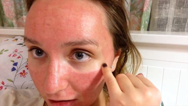 Лазерная ШЛИФОВКА: до, в процессе и после смотреть онлайн