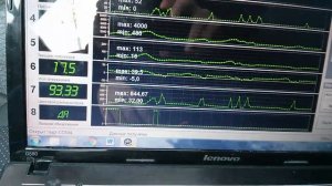 Проблема с датчиком детонации