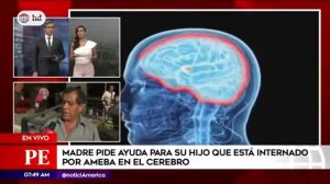 INSN: Susalud respondió por caso de niño con "Ameba comecerebros" (VIDEO)