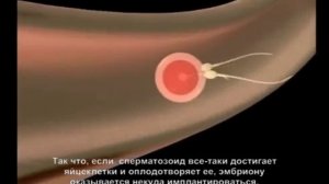 Абортивное действие контрацептивных таблеток