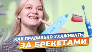 УХОД ЗА ЗУБАМИ ВО ВРЕМЯ НОШЕНИЯ БРЕКЕТОВ