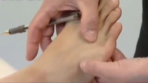 VB41 Цзу-линь-ци