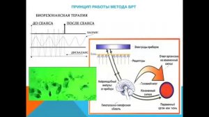 БРТ –  технологии на страже Вашего здоровья