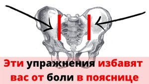 Убираем боль в крестуово-подвздошном сочленении. Комплекс упражнений.
