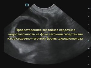 Дирофиляриоз у собаки | Асцит | ЭХО собаке