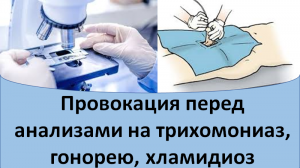 Провокация перед анализами на трихомониаз, гонорею и хламидиоз