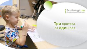 Косметический, тяговый, рабочий протезы рук