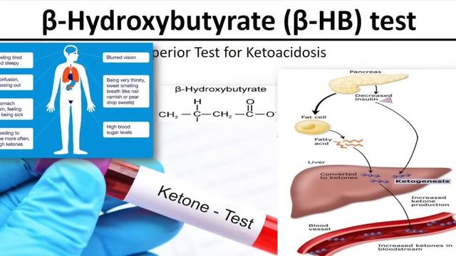 Dr. Zee:This Carb Does Not Spike Insulin  کیا کھائیں  खन म शककर