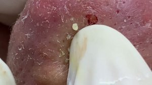 Satisfying Relaxing Best Video with Win Spa #119