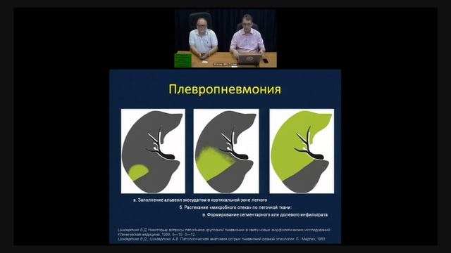 Лучевая диагностика пневмонии.