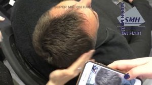 Как сделать волосы гуще за 10 секунд? Загуститель для волос Super Million Hair!