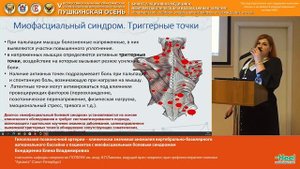 Бондаренко Елена Владимировна  Гипоплазия позвоночной артерии