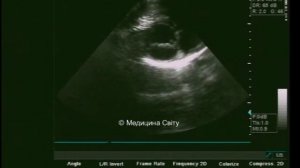 Основы проведения эхокардиографии