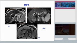Г.А. Сташук - Очаговые образования печени