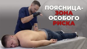 Поясница - зона особого риска|Костоправ Матвеев Олег