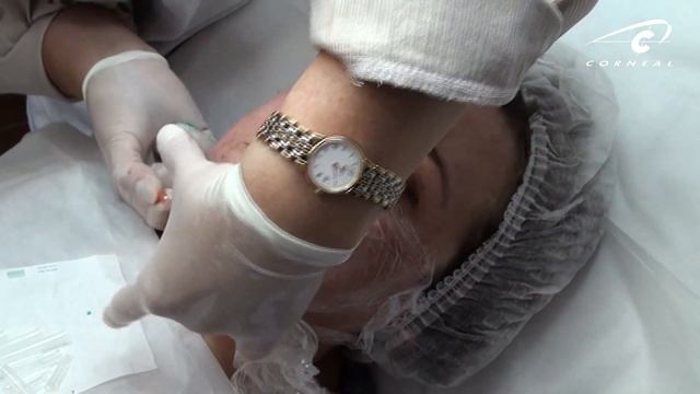 Мезонити и мезораствор одновременно! смотреть онлайн