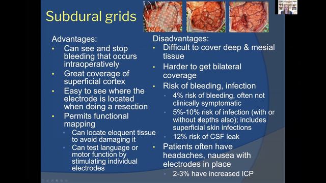 Temporal Lobe Epilepsy Seminar 1: Overview смотреть онлайн