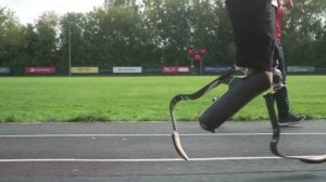 Беговые протезы голени и бедра.