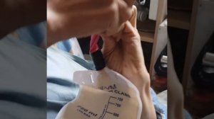 Мочеприемник без катетера своими руками.