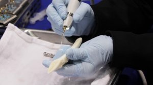 How Piezosurgery® is Changing Bone Surgery in Dentistry