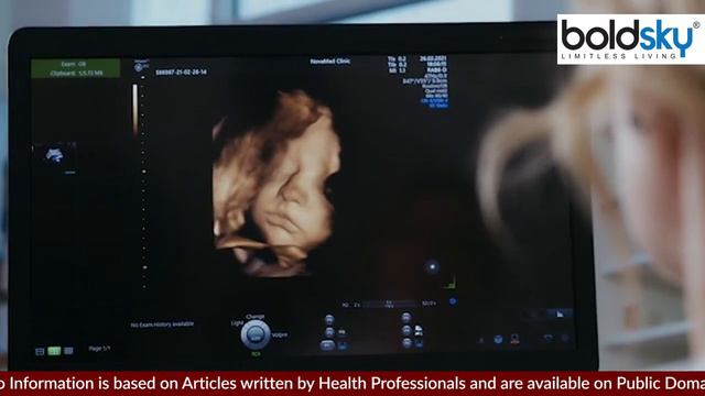 कान के ऊपर छेद होना Preauricular Pit, Preauricular Ear Hole क्या है | Boldsky *Health смотреть онлайн