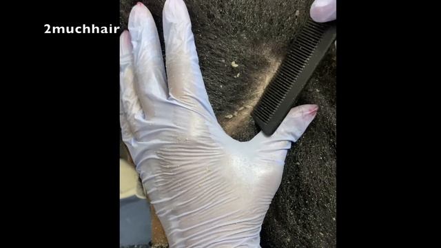 What's Inside This Puff? Dandruff Addiction смотреть онлайн