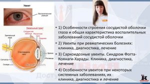 Курс "Актуальные вопросы диагностики и лечения увеитов при системных и синдромных заболеваниях"