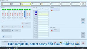Snibe MAGLUMI процедура использования наборов 2019-nCoV igG/M