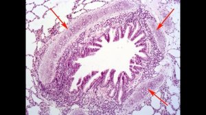 Дыхательная система. Гистологические препараты