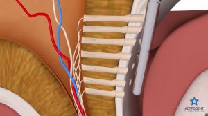 Аппарат Vector в стоматологии "Астродент" (HD)