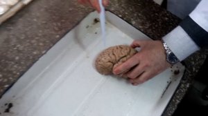 Анатомия конечный мозг внешнее строение