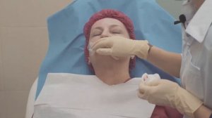 Омоложение возрастных губ и подбородка филлерами